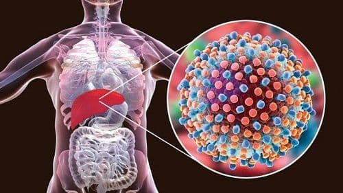 All you need to know about Hepatitis C infection