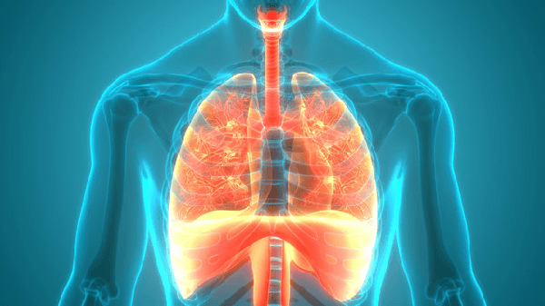 What are the 4 Stages of IPF?