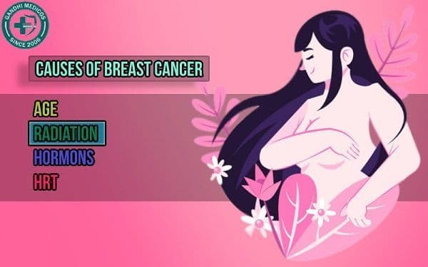 What are the Causes of Breast Cancer?