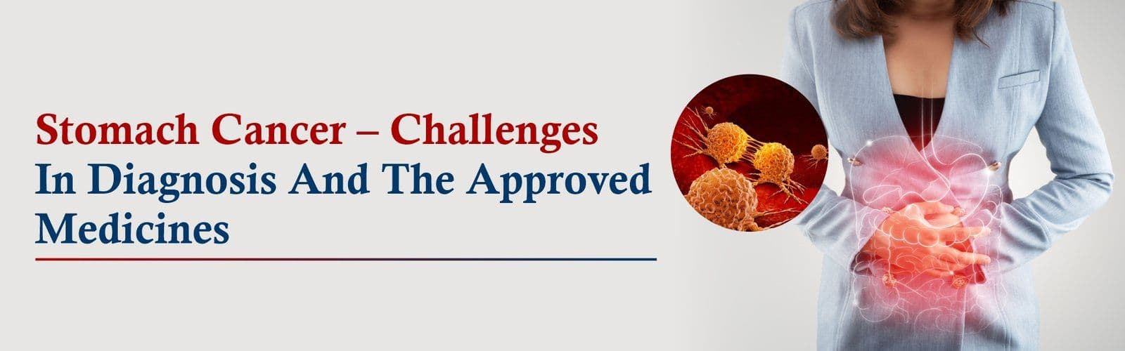 Stomach Cancer – Challenges in Diagnosis and the Approved Medicines