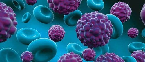 Cancer – A Curable Disease with the right Diagnosis and Medical Intervention