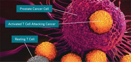 How to Treat Castrate-Resistant Prostate Cancer (CRPC)