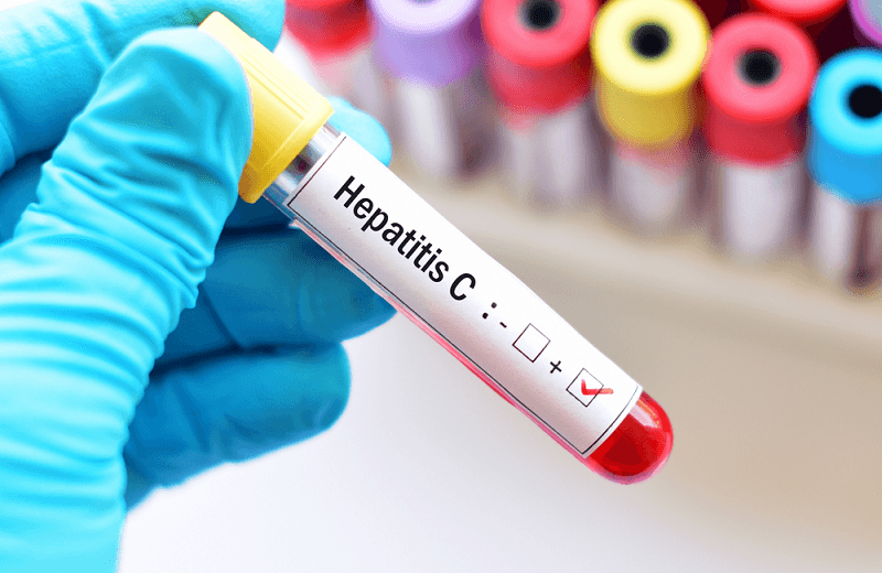 Hepatitis C – How The Treatment Works