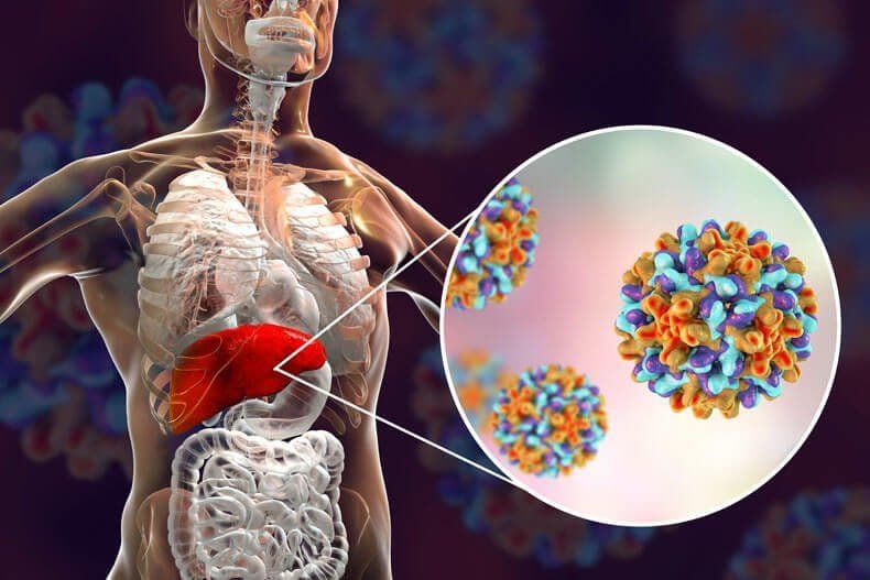 Difference Between Chronic and Acute Hepatitis C
