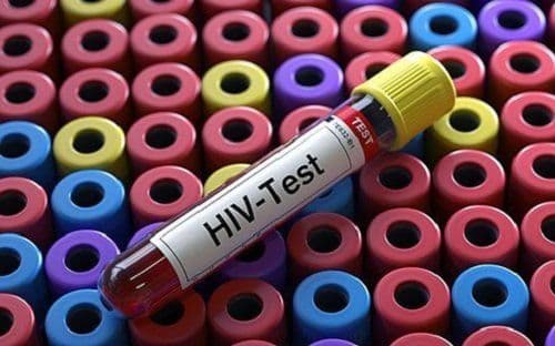 Analyzing HIV and what leads to AIDS