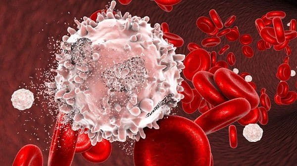Types of Blood Cancers and their Treatment