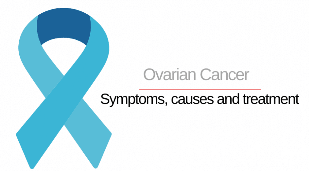 What are the Symptoms and Causes of Ovarian Cancer