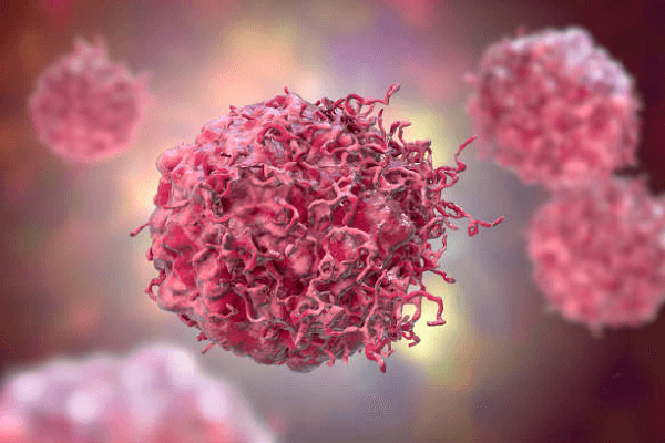 What is the Treatment for Soft Tissue Sarcoma (STS)?
