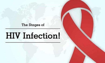 Stages of HIV