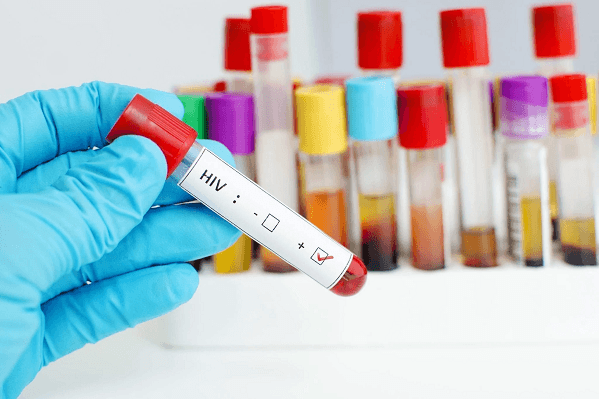 What are the Three Stages or Types of HIV Infection?