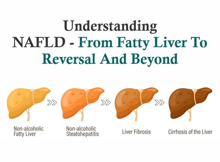 Understanding NAFLD – From Fatty Liver to Reversal and Beyond