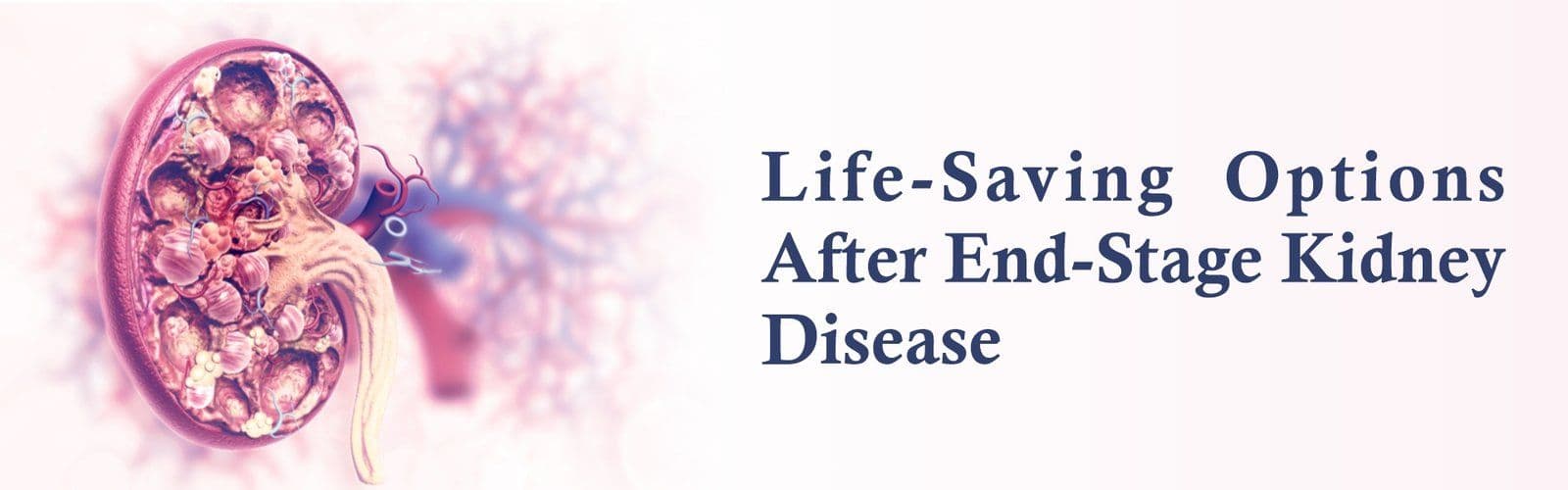 Life-Saving Options After End-Stage Kidney Disease