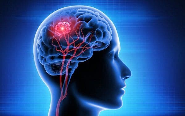 What is the Survival Rate of Brain Cancer?