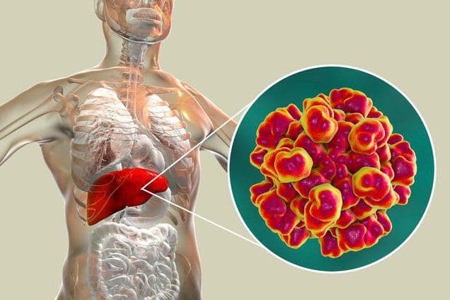 Prevention and Treatment of Hepatitis C