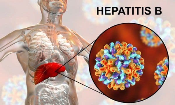 Hepatitis B Guide: Causes, Symptoms, and Treatment Options