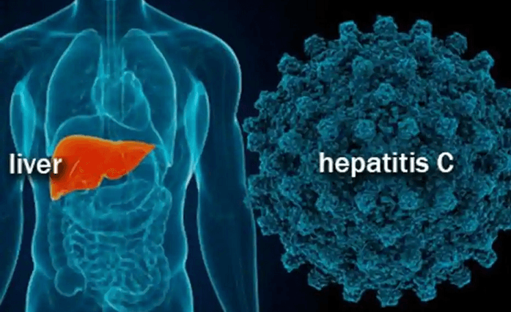 Hepatitis C Know The Causes And The Effects