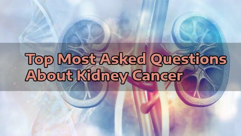 Top Most Asked Questions About Kidney Cancer