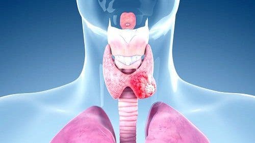 Differentiated Thyroid Cancer- What to Know?