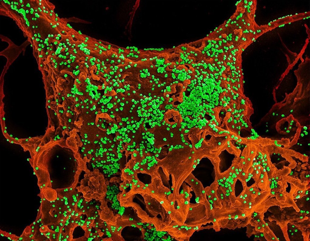 Some Common Questions About Coronavirus
