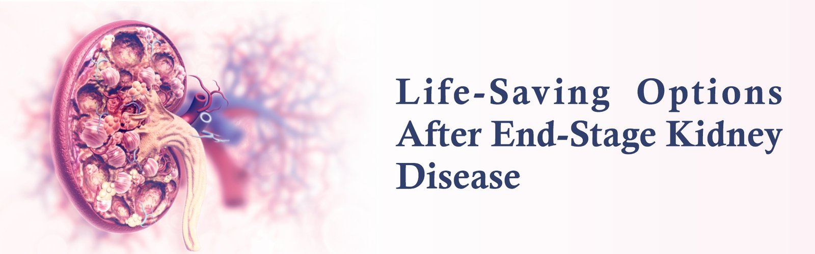 Life-Saving Options After End-Stage Kidney Disease
