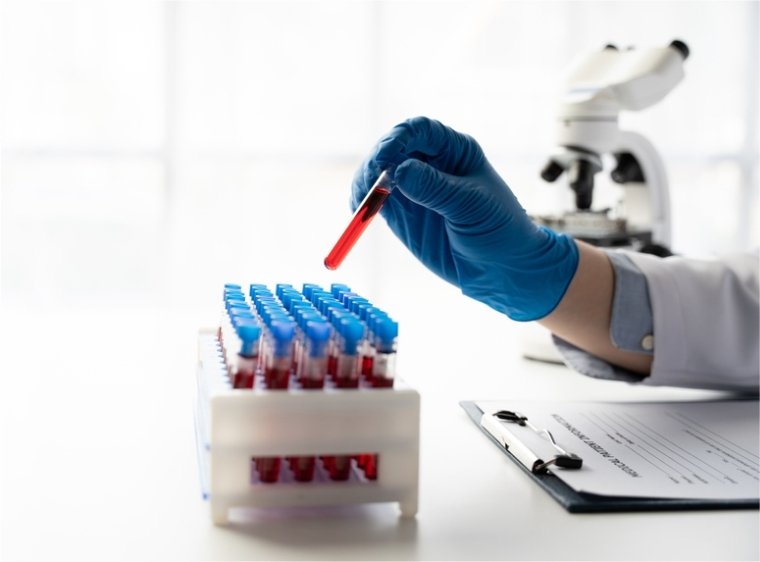 Types of Blood Cancer and Treatments