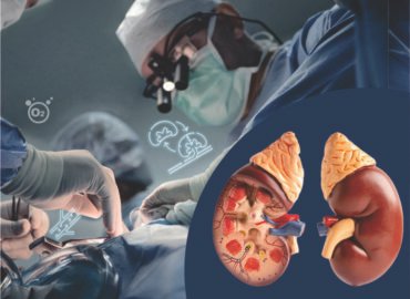 Which is Better Kidney Transplant or Dialysis?