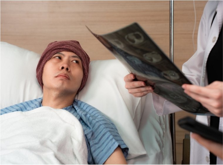 Chemo Brain-Causes, Symptoms, and Management